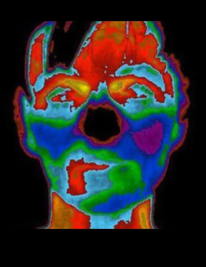 We value the concept of thermography, we have seen the transformative power of thermography in dental care.