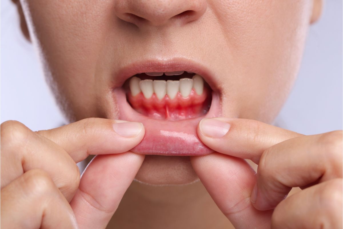 can gum disease affect your overall health